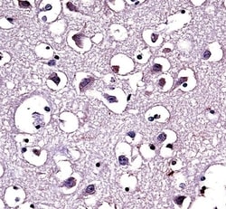 Invitrogen LPL Polyclonal Antibody 400 &mu;L; Unconjugated:Antibodies,