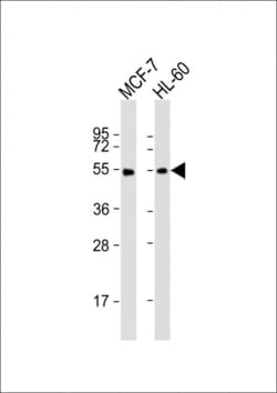 Invitrogen LPL Polyclonal Antibody 400 &mu;L; Unconjugated:Antibodies,