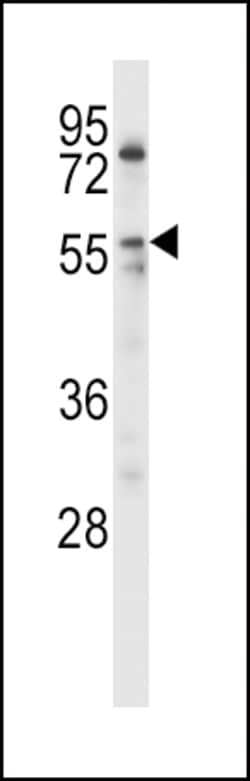 Invitrogen LPL Polyclonal Antibody 400 &mu;L; Unconjugated:Antibodies,