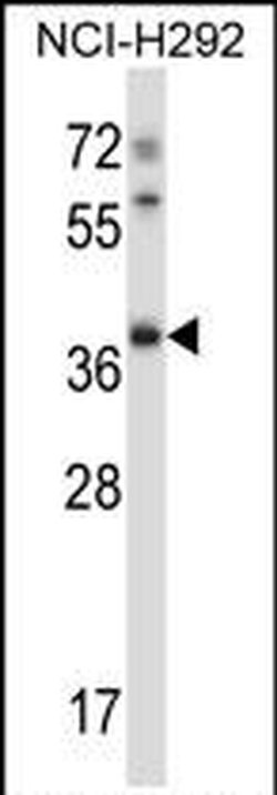 TSSK6 Rabbit anti-Human, Mouse, Polyclonal, Invitrogen 400 &mu;L; Unconjugated:Antibodies,