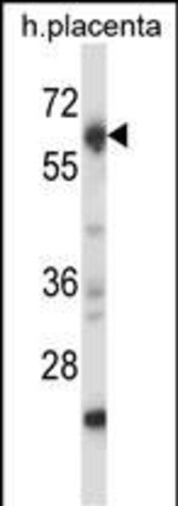 Invitrogen NRBP2 Polyclonal Antibody 400 &mu;L | Buy Online | Invitrogen&trade; | Fisher Scientific