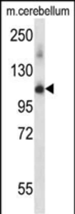 Invitrogen PRPF4B Polyclonal Antibody 400 &mu;L; Unconjugated:Antibodies,