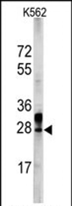 ERAS Rabbit anti-Human, Polyclonal, Invitrogen 400 &mu;L; Unconjugated:Antibodies,
