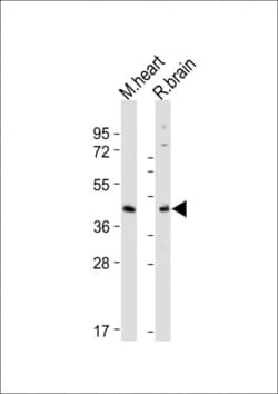 Invitrogen GPR30 Polyclonal Antibody 400 &mu;L; Unconjugated:Antibodies,