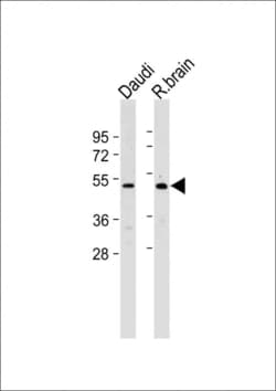 Invitrogen GPR30 Polyclonal Antibody 400 &mu;L; Unconjugated:Antibodies,