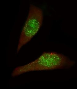 Invitrogen USP27X Polyclonal Antibody 400 &mu;L; Unconjugated:Antibodies,