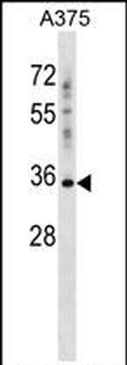 PSG2 Rabbit anti-Human, Polyclonal, Invitrogen 400 &mu;L; Unconjugated:Antibodies,