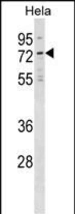 Invitrogen NET1 Polyclonal Antibody 400 &mu;L | Buy Online | Invitrogen&trade; | Fisher Scientific