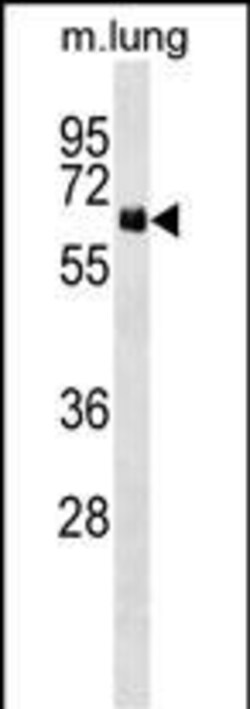 Invitrogen NET1 Polyclonal Antibody 400 &mu;L | Buy Online | Invitrogen&trade; | Fisher Scientific