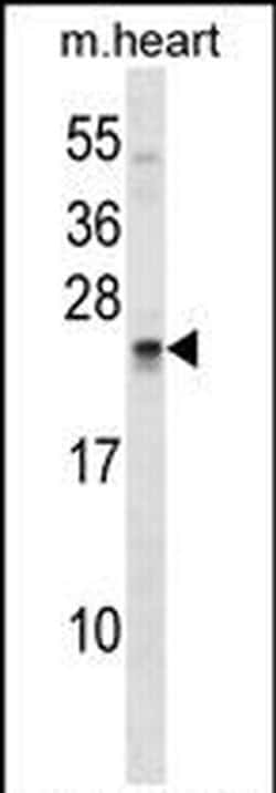 Sostdc1 Rabbit anti-Human, Mouse, Polyclonal, Invitrogen 400 &mu;L; Unconjugated:Antibodies,