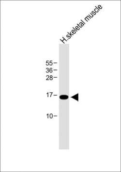 Invitrogen EMP1 Polyclonal Antibody 400 &mu;L; Unconjugated:Antibodies,
