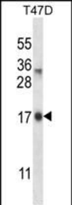 Invitrogen IGF2-AS Polyclonal Antibody 400 &mu;L; Unconjugated:Anticuerpos
