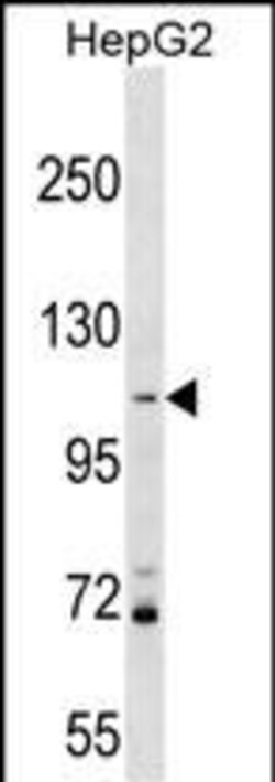 Invitrogen PROSER1 Polyclonal Antibody 400 &mu;L | Buy Online | Invitrogen&trade; | Fisher Scientific