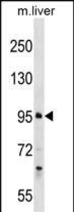 Invitrogen PROSER1 Polyclonal Antibody 400 &mu;L | Buy Online | Invitrogen&trade; | Fisher Scientific