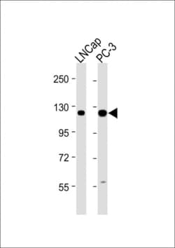 Invitrogen DSPP Polyclonal Antibody 400 &mu;L; Unconjugated:Antistoffer