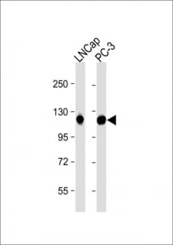 Invitrogen DSPP Polyclonal Antibody 400 &mu;L; Unconjugated:Antistoffer