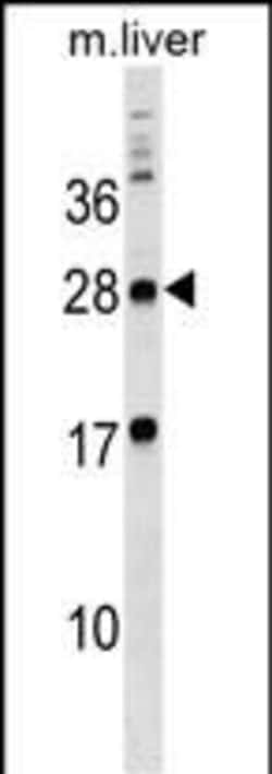 Invitrogen MPZL3 Polyclonal Antibody 400 &mu;L | Buy Online | Invitrogen&trade; | Fisher Scientific