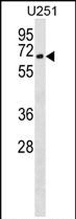 Coronin 2B Rabbit anti-Human, Polyclonal, Invitrogen 400 &mu;L; Unconjugated:Antibodies,