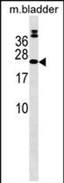 COMMD10 Rabbit anti-Human, Mouse, Polyclonal, Invitrogen 400 &mu;L; Unconjugated:Antibodies,
