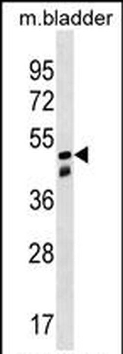 SNX8 Rabbit anti-Human, Mouse, Polyclonal, Invitrogen 400 &mu;L; Unconjugated:Antibodies,
