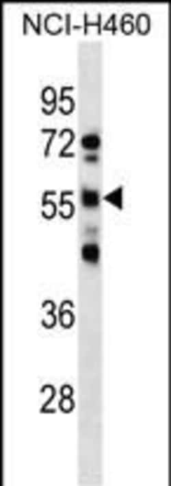 Invitrogen RBMY1D Polyclonal Antibody 400 &mu;L; Unconjugated:Antibodies,