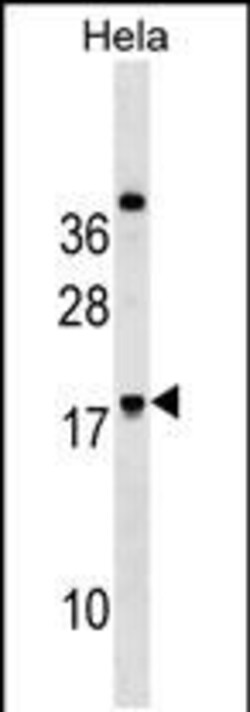 Invitrogen RNF224 Polyclonal Antibody 400 &mu;L; Unconjugated:Antibodies,