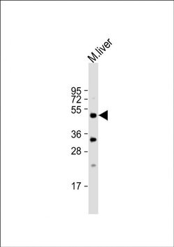 STK38 Rabbit anti-Mouse, Polyclonal, Invitrogen 400 &mu;L | Buy Online | Thermo Scientific | Fisher Scientific