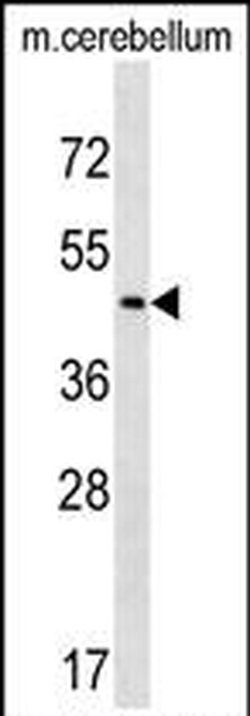 CHST2 Rabbit anti-Human, Mouse, Polyclonal, Invitrogen 400 &mu;L; Unconjugated:Antibodies,