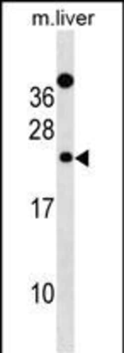 Invitrogen DERL2 Polyclonal Antibody 400 &mu;L; Unconjugated:Antibodies,