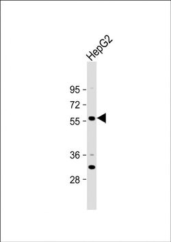 ST6GAL2 Rabbit anti-Human, Polyclonal, Invitrogen 400 &mu;L; Unconjugated:Antibodies,