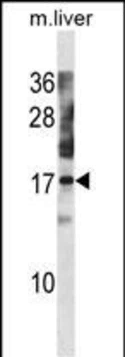 Invitrogen NXT1 Polyclonal Antibody 400 &mu;L; Unconjugated:Antibodies,