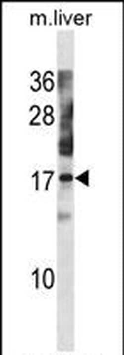 NXT1 Polyclonal Antibody, Invitrogen 400 &mu;L; Unconjugated:Antibodies,
