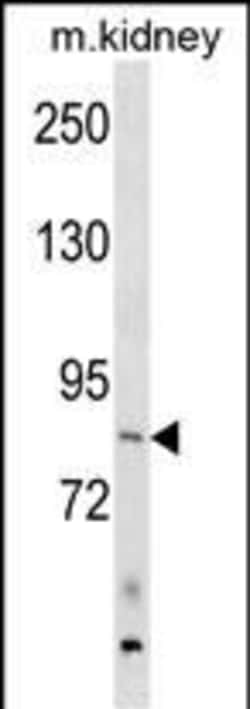 Invitrogen ARHGEF16 Polyclonal Antibody 400 &mu;L | Buy Online | Invitrogen&trade; | Fisher Scientific