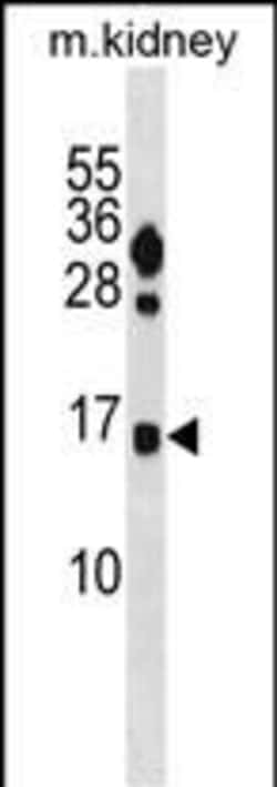 Invitrogen FUNDC2 Polyclonal Antibody 400 &mu;L; Unconjugated:Antibodies,