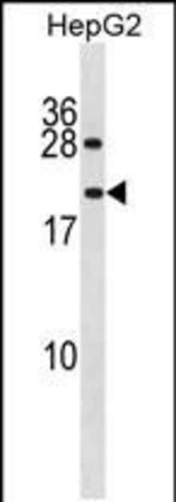 Invitrogen™ PPIAL4A Polyclonal Antibody