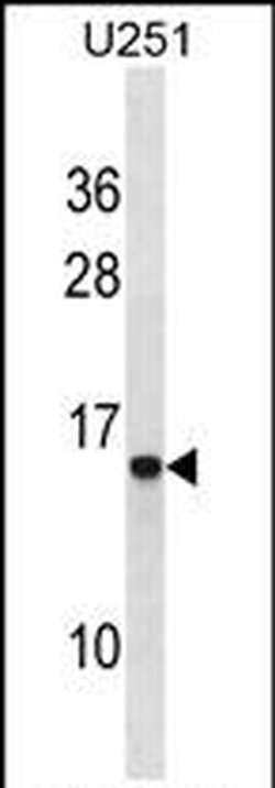HPa1 Rabbit anti-Human, Polyclonal, Invitrogen 400 &mu;L; Unconjugated:Antibodies,