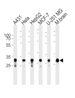 Invitrogen Cytochrome C1 Polyclonal Antibody 400 &mu;L; Unconjugated:Antibodies,