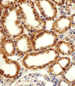 Invitrogen alpha-1D Adrenoceptor Polyclonal Antibody 400 &mu;L; Unconjugated:Antibodies,