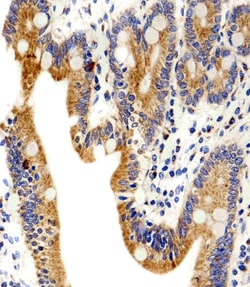 Invitrogen alpha-1D Adrenoceptor Polyclonal Antibody 400 &mu;L; Unconjugated:Antibodies,