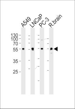 Invitrogen alpha-1D Adrenoceptor Polyclonal Antibody 400 &mu;L; Unconjugated:Antibodies,