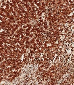 Invitrogen Cathepsin D Polyclonal Antibody 400 &mu;L; Unconjugated:Antibodies,