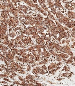 Invitrogen Cathepsin D Polyclonal Antibody 400 &mu;L; Unconjugated:Antibodies,