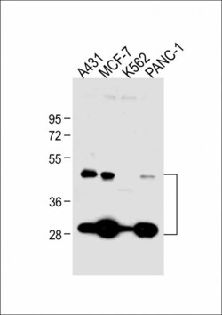 Invitrogen Cathepsin D Polyclonal Antibody 400 &mu;L; Unconjugated:Antibodies,