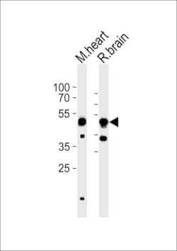 Invitrogen CHRNB3 Polyclonal Antibody 400 &mu;L; Unconjugated:Antibodies,