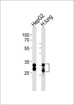 SULT1A1 Rabbit anti-Human, Polyclonal, Invitrogen 400 &mu;L; Unconjugated:Antibodies,