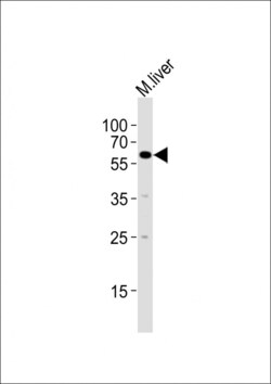 Invitrogen SRMS Polyclonal Antibody 400 &mu;L; Unconjugated:Antibodies,