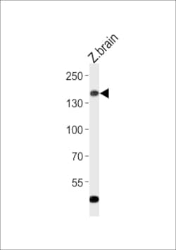 Invitrogen GPR126 Polyclonal Antibody 400 &mu;L; Unconjugated:Antibodies,