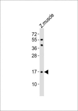 Invitrogen TMEM166 Polyclonal Antibody 400 &mu;L; Unconjugated:Antibodies,