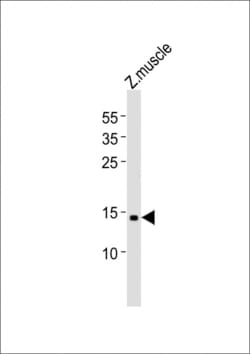 Invitrogen GABARAPL2 Polyclonal Antibody 400 &mu;L; Unconjugated:Antibodies,