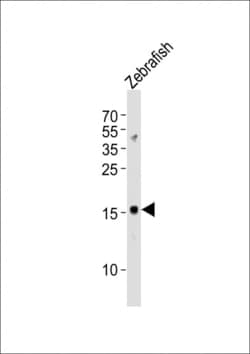 Invitrogen GABARAPL2 Polyclonal Antibody 400 &mu;L; Unconjugated:Antibodies,